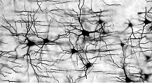 Model Extremely Complex Functions Neural Networks